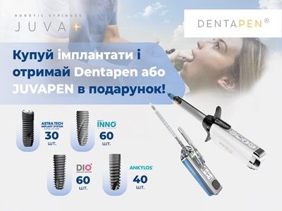 Імплантуєш — отримуєш інновацію!