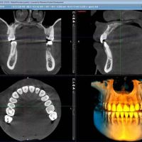 3D рентген-апарат PROMAX 3D Classic