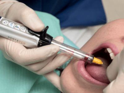 Чому варто використовувати Dentapen для стоматологічної анестезії?