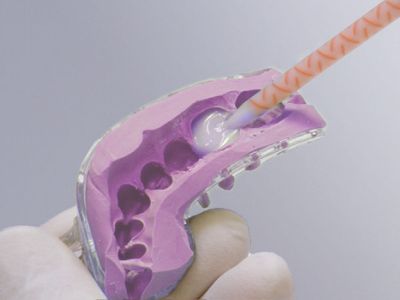 Тест-драйв передніх реставрацій для досягнення естетичного результату Тест-драйв передніх реставрацій для досягнення естетичного результату