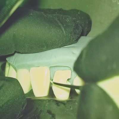 Майстер-клас «Пряма художня реставрація фронтальних зубів» — понад 100 стоматологів обрали розвиток