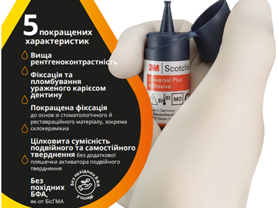 3 причини обирати універсальні адгезиви 3 причини обирати універсальні адгезиви