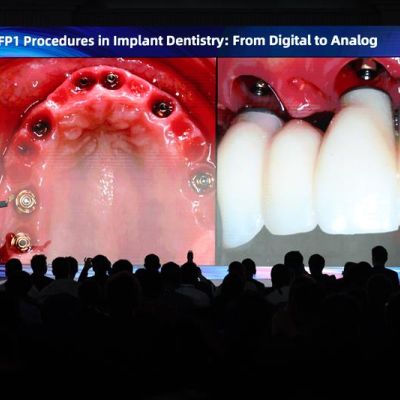 Українська делегація на CIC 2025 у Шанхаї: міжнародний досвід для розвитку імплантології разом із Cowellmedi