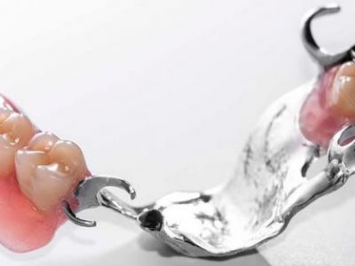 Сплави HERAENIUM® - для зуботехнічної лиття