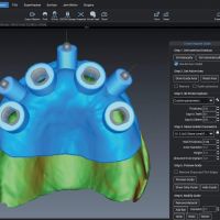 Модуль Romexis 3D Implant Guide