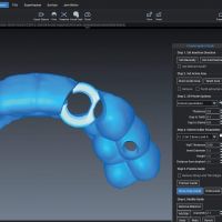 Модуль Romexis 3D Implant Guide