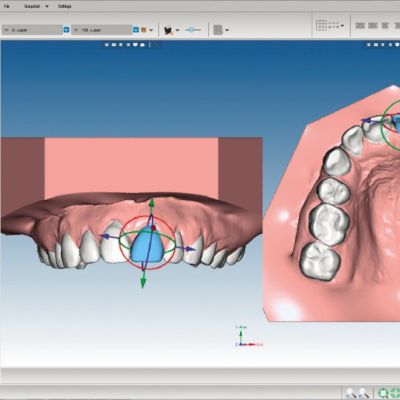 Модуль Romexis® 3D Ortho Studio
