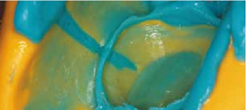 Express XT Light Body