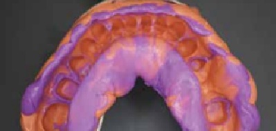 Зняття відбитку під вкладку